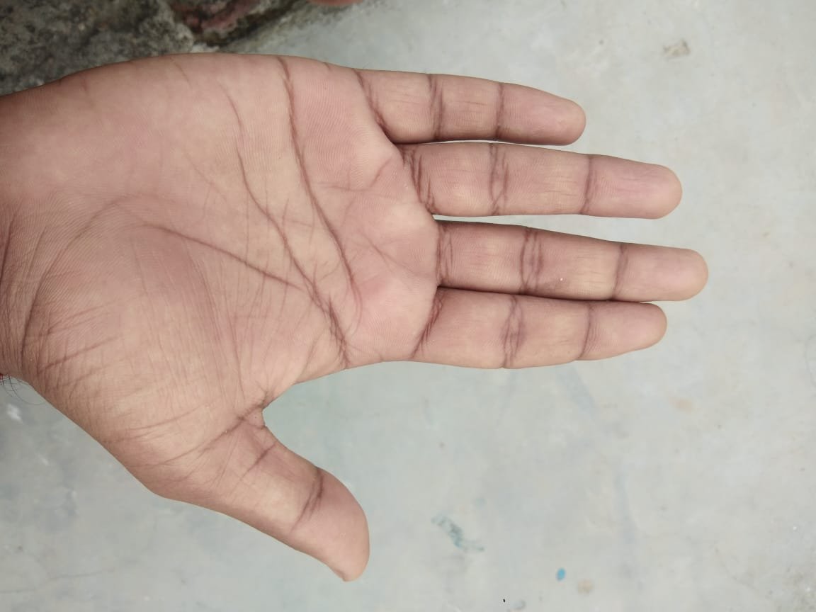 No Image Available