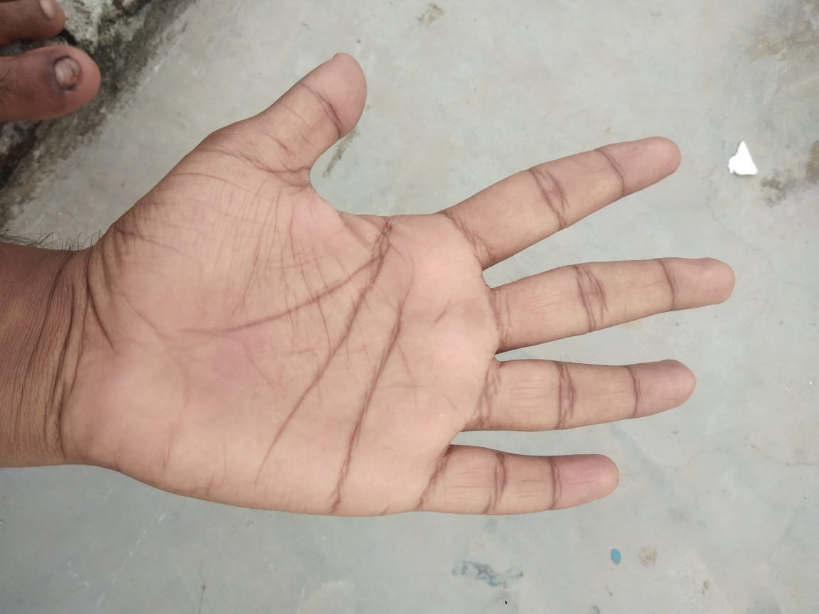 No Image Available