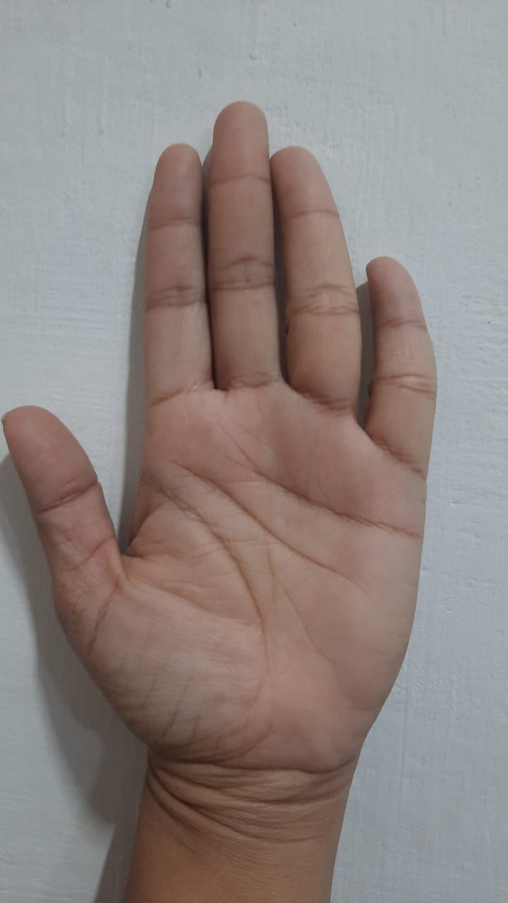 No Image Available